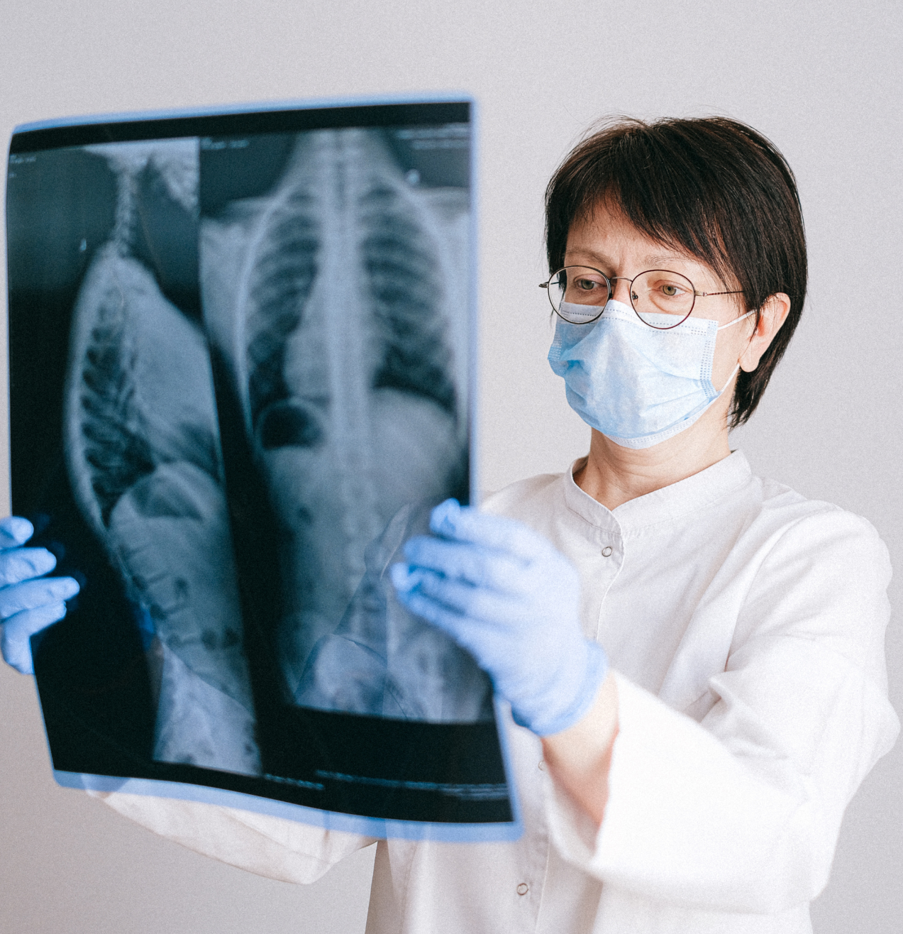 doctor holding and examining xray of lungs for pneumonia