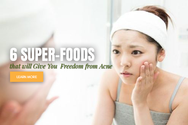 face acne free